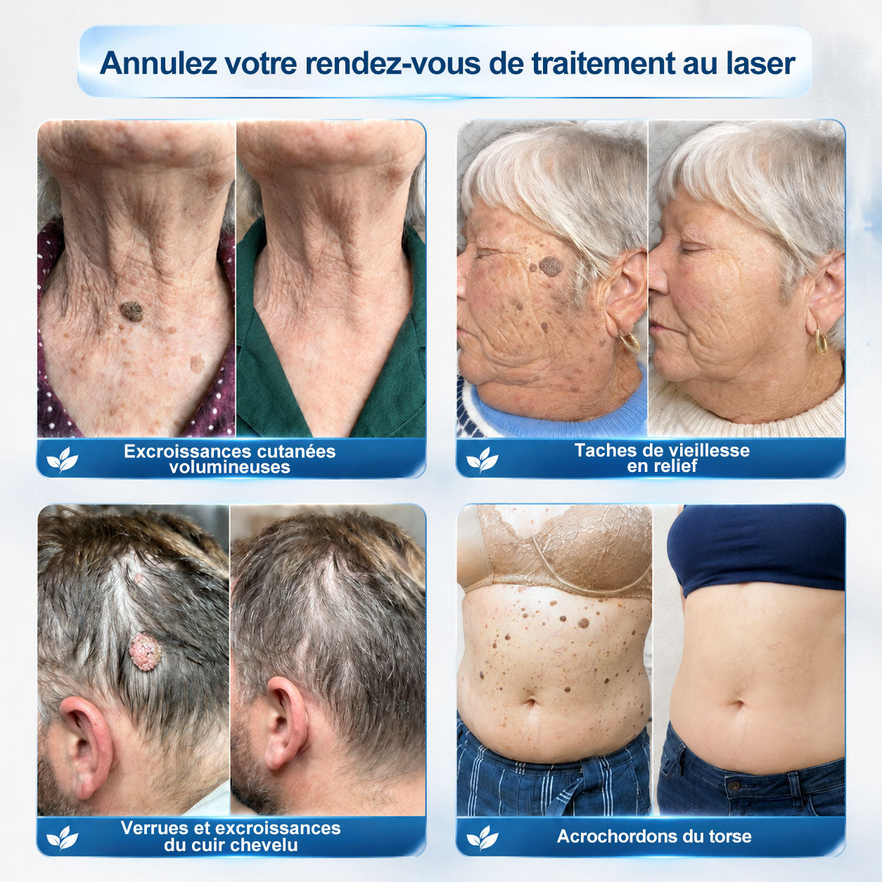 🎉𝐇𝐞𝒂𝒍𝗿𝗶𝙯𝙚®– Félicitations ! Vous êtes notre grand gagnant 🎁 Vous bénéficiez de 30 % de réduction sur votre commande, soit la moitié du prix. Profitez de cette offre pour vous faire plaisir à moindre coût. Offre limitée dans le temps ✨