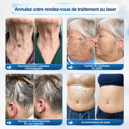 🎉𝐇𝐞𝒂𝒍𝗿𝗶𝙯𝙚®– Félicitations ! Vous êtes notre grand gagnant 🎁 Vous bénéficiez de 30 % de réduction sur votre commande, soit la moitié du prix. Profitez de cette offre pour vous faire plaisir à moindre coût. Offre limitée dans le temps ✨