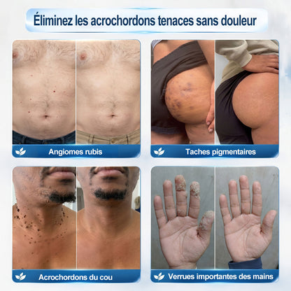 🎉𝐇𝐞𝒂𝒍𝗿𝗶𝙯𝙚®– Félicitations ! Vous êtes notre grand gagnant 🎁 Vous bénéficiez de 30 % de réduction sur votre commande, soit la moitié du prix. Profitez de cette offre pour vous faire plaisir à moindre coût. Offre limitée dans le temps ✨