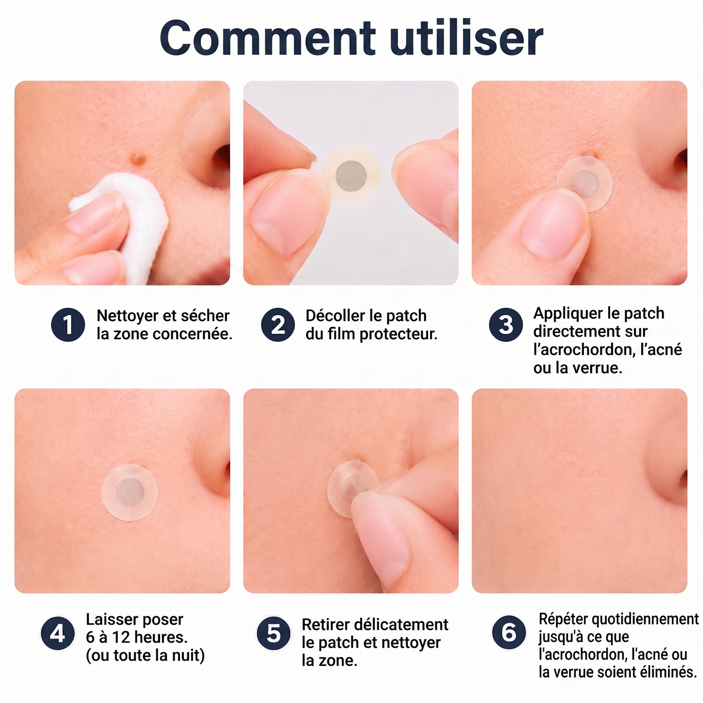 ✅🇫🇷 **Healrize® Patch 2-en-1 à micro-aiguilles & hydrocolloïde** 💫 Aide à réduire l’apparence des grains de beauté en relief, de l’acné, des verrues planes et des acrochordons | Patchs invisibles pour le visage et le corps