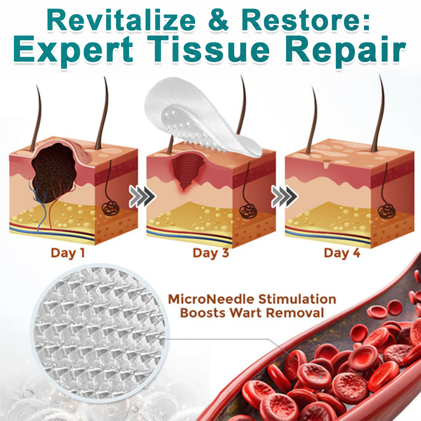 ✅🇦🇺𝐇𝐞𝒂𝒍𝗿𝗶𝙯𝙚®2-in-1 Microneedle & Hydrocolloid Patch💫| Removes Raised Moles, Acne, Flat Warts & Skin Tags | Helps Improve Wrinkles, Scars & Blemishes | Invisible Patches for Face & Body