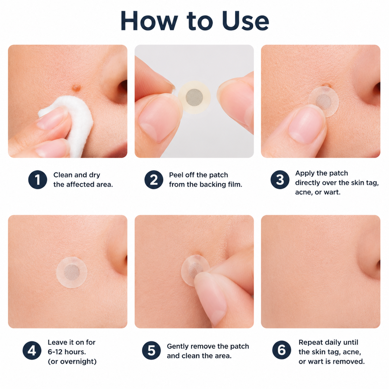 ✅🇦🇺𝐇𝐞𝒂𝒍𝗿𝗶𝙯𝙚®2-in-1 Microneedle & Hydrocolloid Patch💫| Removes Raised Moles, Acne, Flat Warts & Skin Tags | Helps Improve Wrinkles, Scars & Blemishes | Invisible Patches for Face & Body